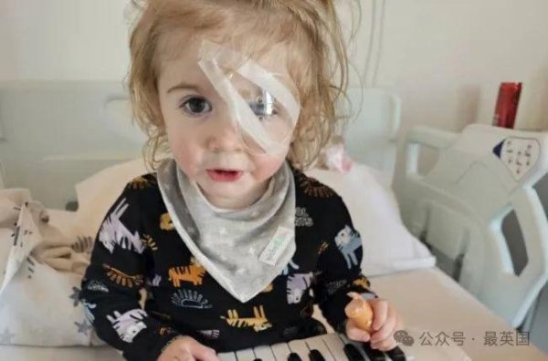 金瑞鼎盛 “千万别乱亲你的娃！”一个吻让2岁宝宝彻底失明，左眼变成一个恐怖的大洞…